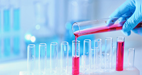 聚合氯化铝检测